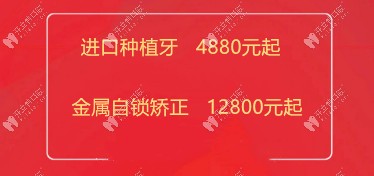 曙光口腔發(fā)來(lái)韓國(guó)登騰種植牙4880元起優(yōu)惠價(jià)格，終于等到了