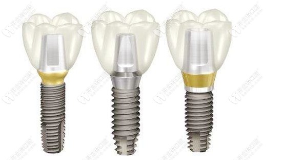 韓國登騰種植體的外觀 韓國登騰種植體的外觀