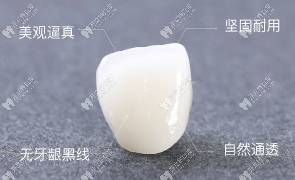全瓷牙冠的優(yōu)勢(shì)介紹圖 全瓷牙冠的優(yōu)勢(shì)介紹圖