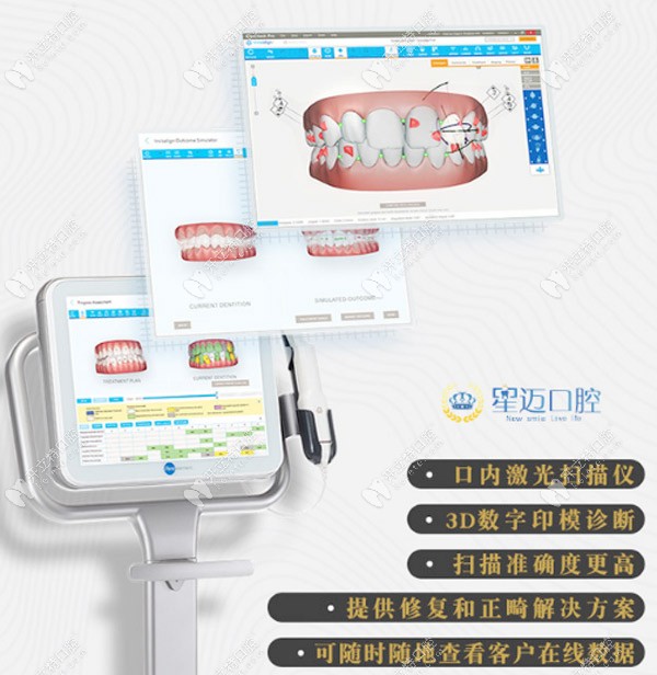 iTero口掃設(shè)備的特點(diǎn) iTero口掃設(shè)備的特點(diǎn)