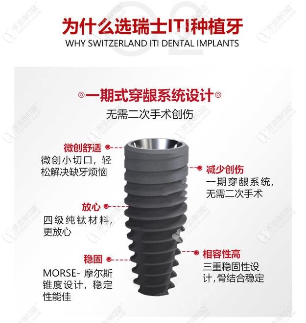 瑞士iti士卓曼種植體好嗎？