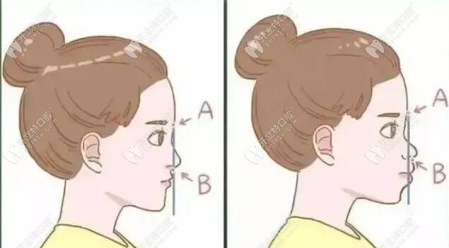 這項(xiàng)技術(shù)針對(duì)國(guó)內(nèi)凸面畸形