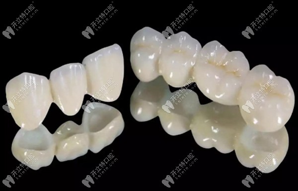 洋紫荊全瓷牙和威蘭德哪個好