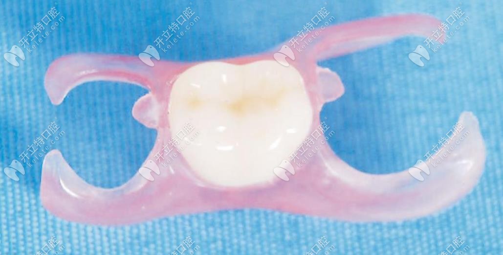 少一顆牙有幾種方法修復(fù),年輕人鑲活動和固定假牙哪種好？