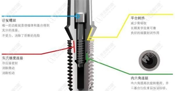 意大利bb種植體與瑞士iti比較，除價(jià)格外還有這些區(qū)別