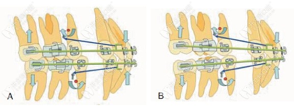 傳動(dòng)矯正技術(shù)原理