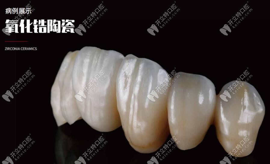 愛(ài)爾創(chuàng)全瓷牙冠美學(xué)修復(fù)