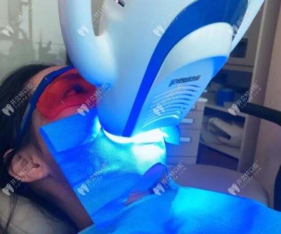 美國(guó)達(dá)妃琦牙齒美白